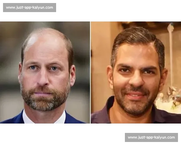 印度亿万富翁马球赛中吞蜂猝死 罕见过敏反应夺命